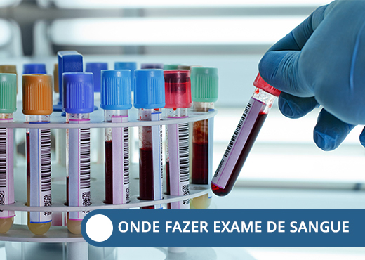 onde fazer exame de sangue 1